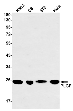 PLGF Rabbit mAb ABZ2434