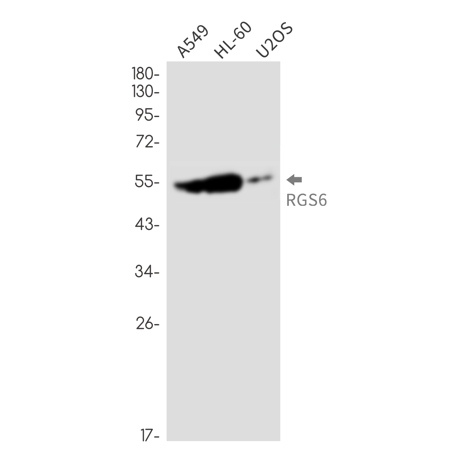 RGS6 Rabbit mAb ABZ2435