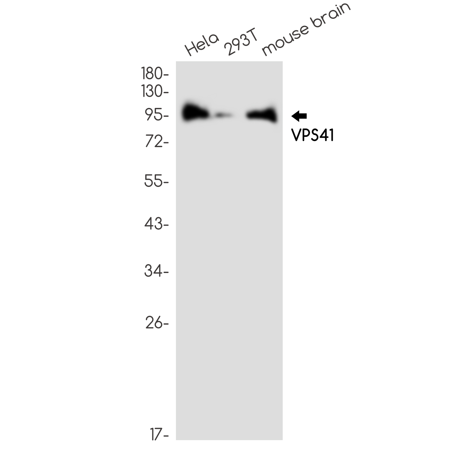 VPS41 Rabbit mAb ABZ2436