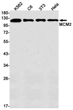 MCM2 Rabbit mAb ABZ2437