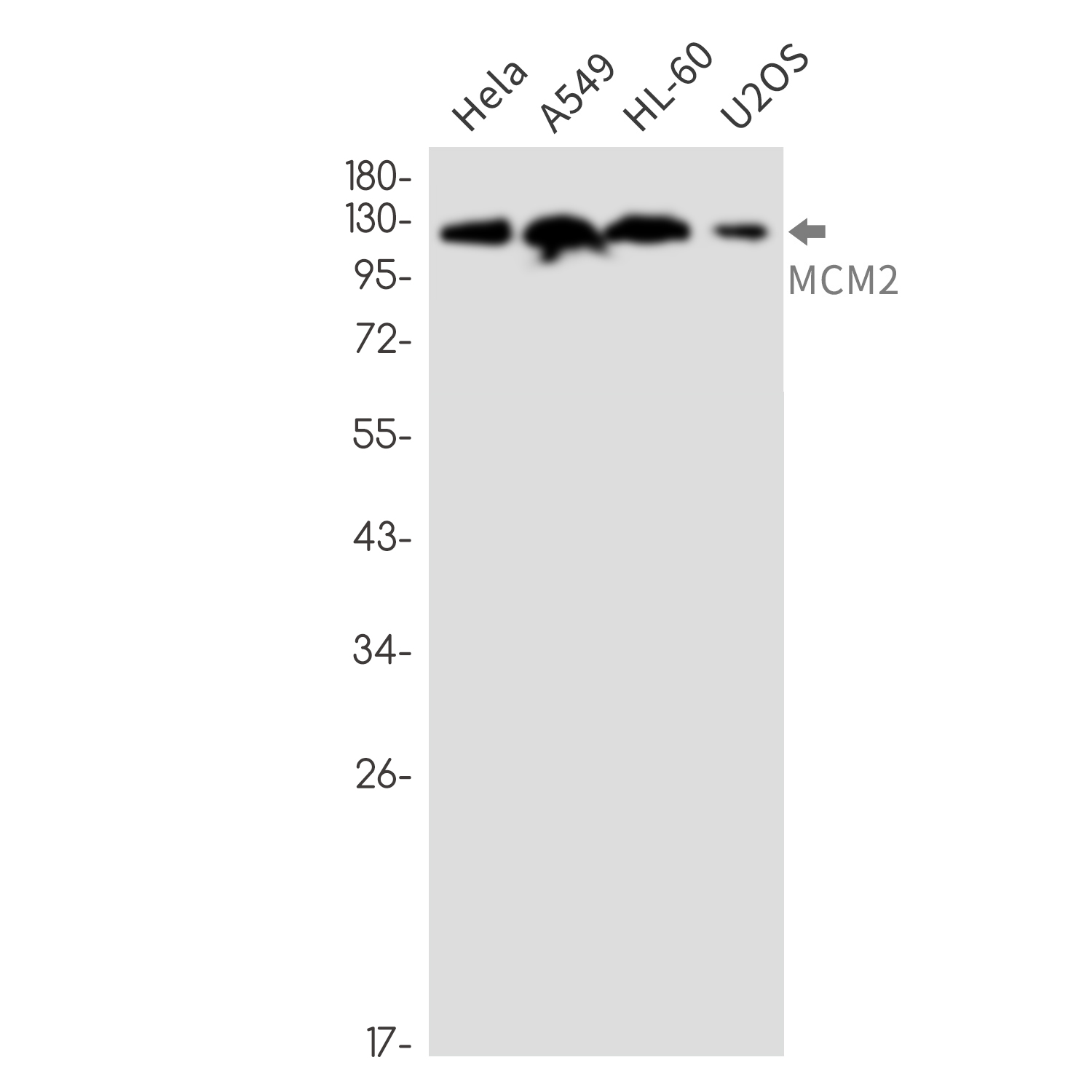 MCM2 Rabbit mAb ABZ2438