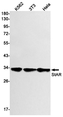 StAR Rabbit mAb ABZ2442
