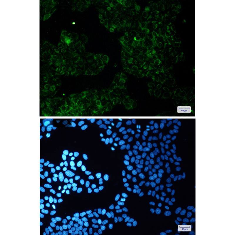 ALDH7A1 Rabbit mAb ABZ2443