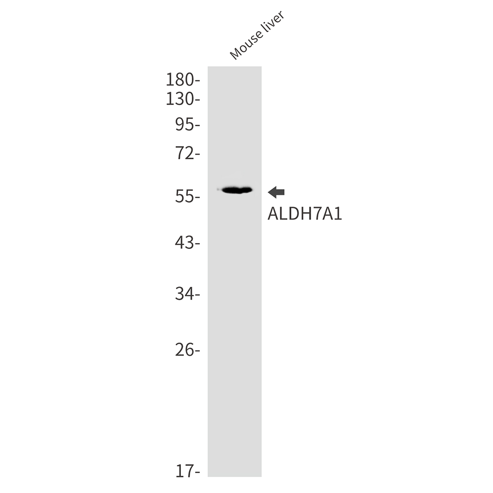 ALDH7A1 Rabbit mAb ABZ2443