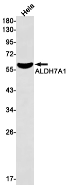 ALDH7A1 Rabbit mAb ABZ2443