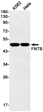 FNTB Rabbit mAb ABZ2444