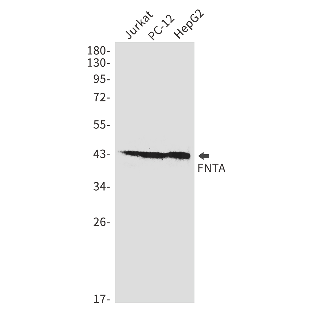 FNTA Rabbit mAb ABZ2445