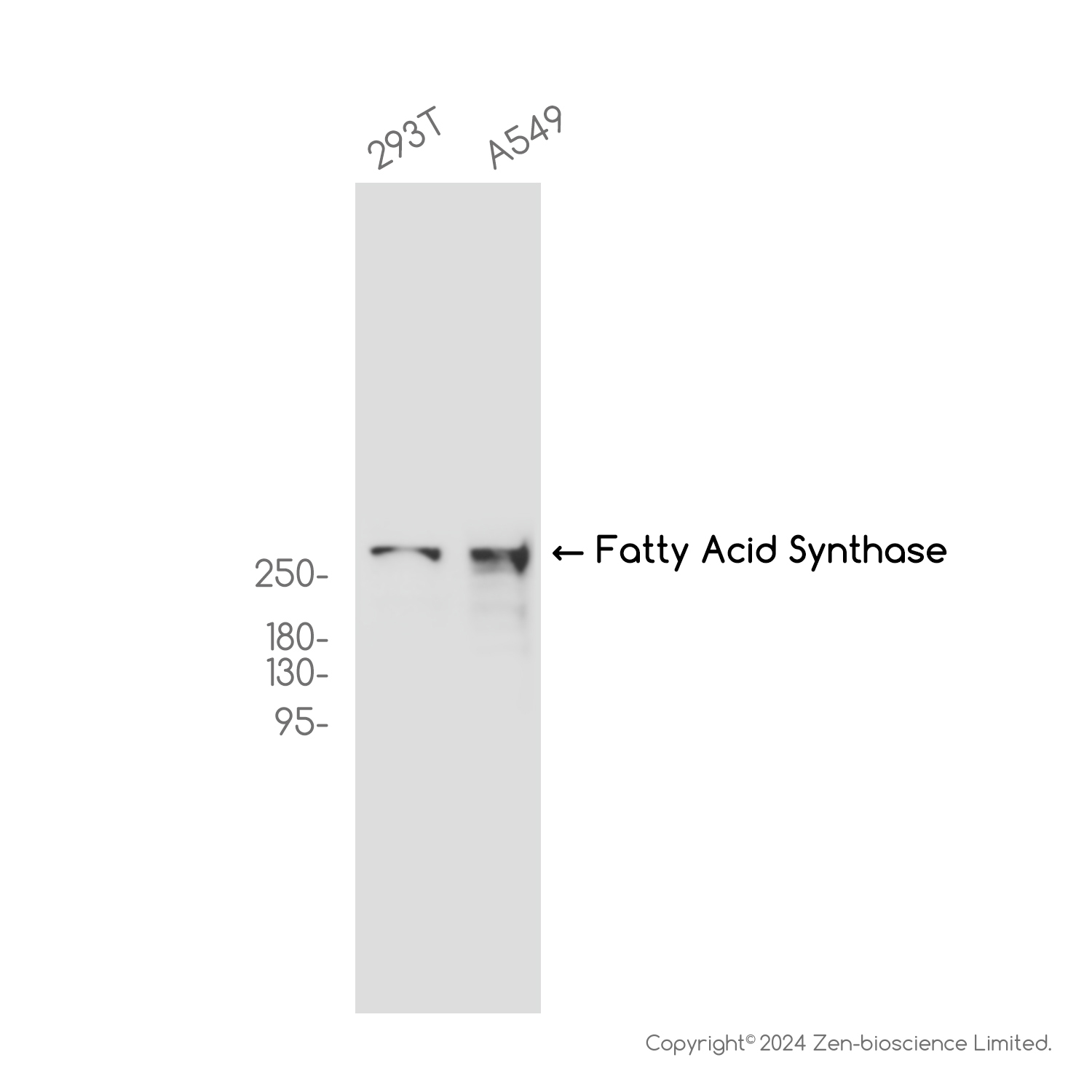 Fatty Acid Synthase Rabbit mAb ABZ2446