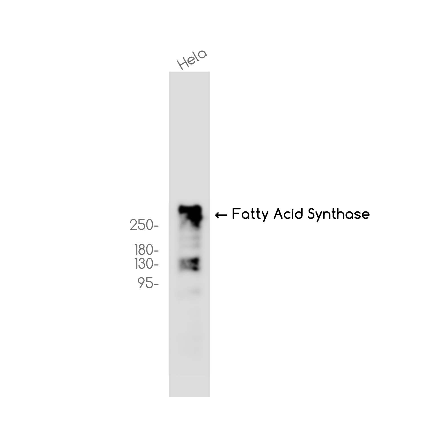 Fatty Acid Synthase Rabbit mAb ABZ2446