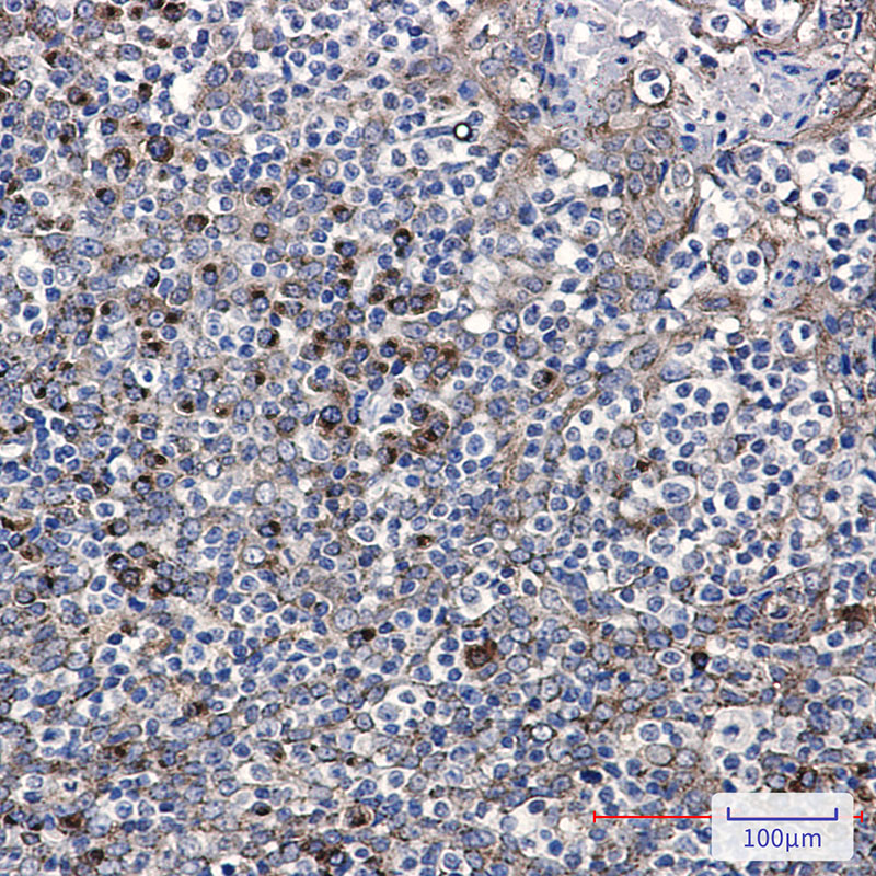 LMAN1 Rabbit mAb ABZ2447