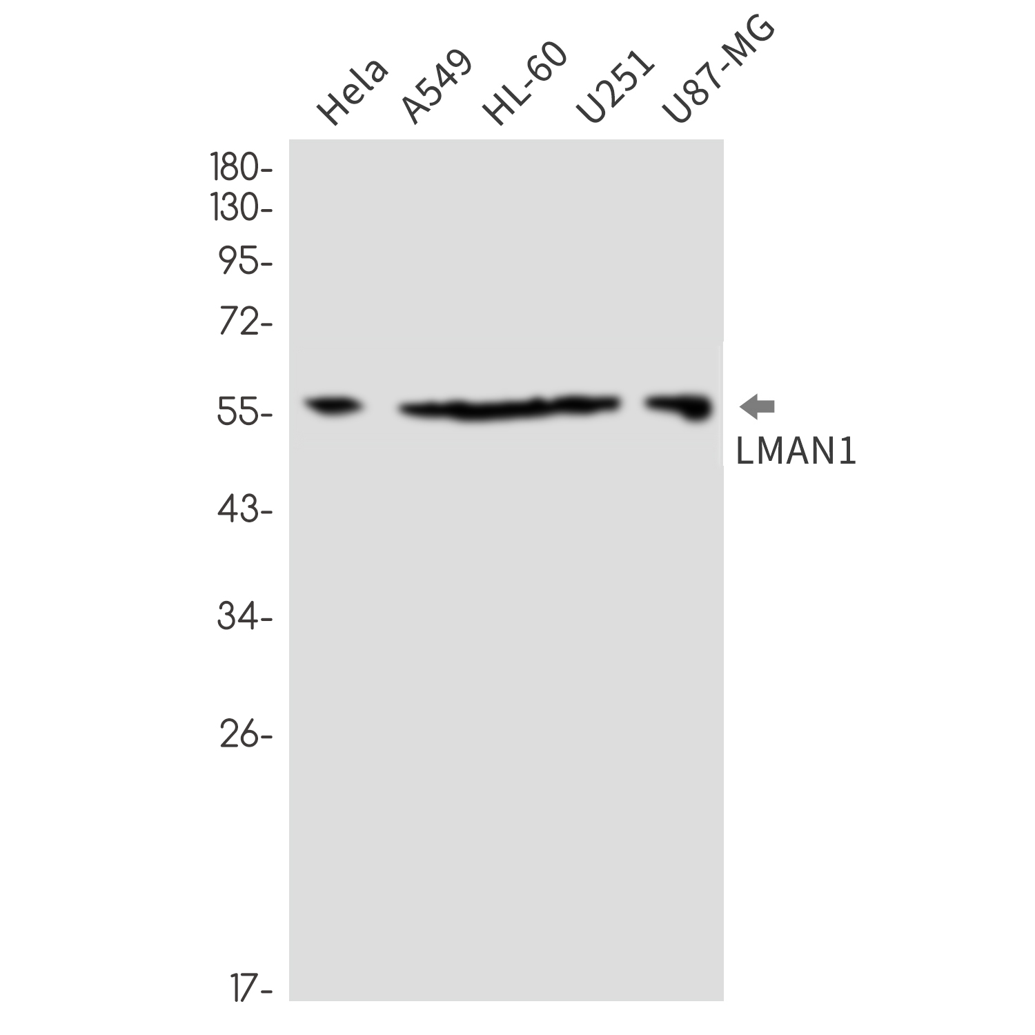 LMAN1 Rabbit mAb ABZ2447