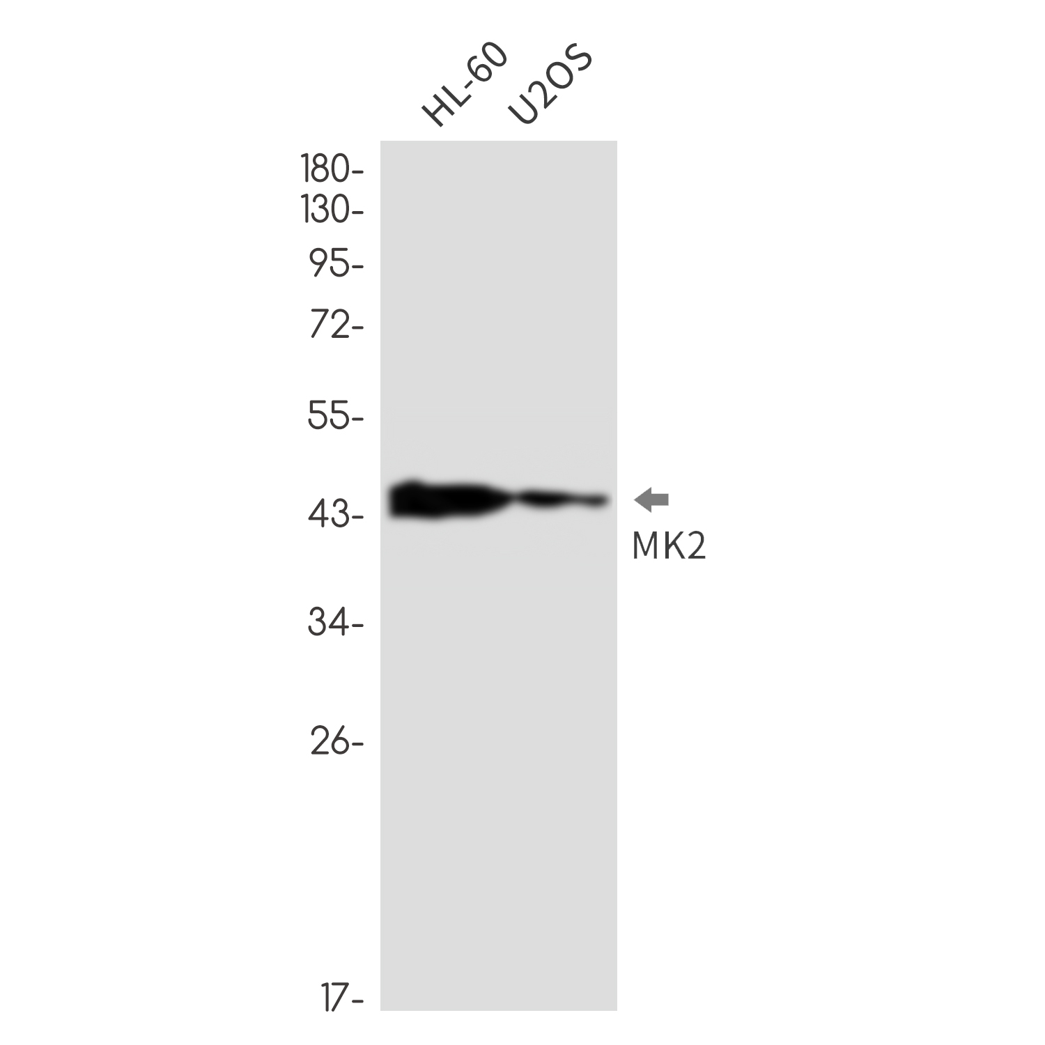 MK2 Kinase 2 Rabbit mAb ABZ2448