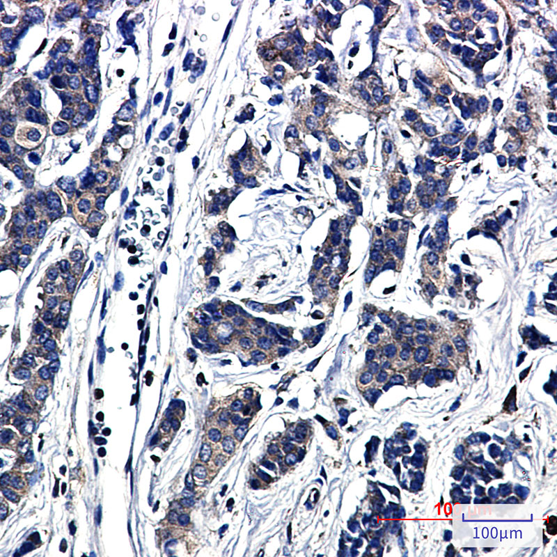 Paxillin Rabbit mAb ABZ2449
