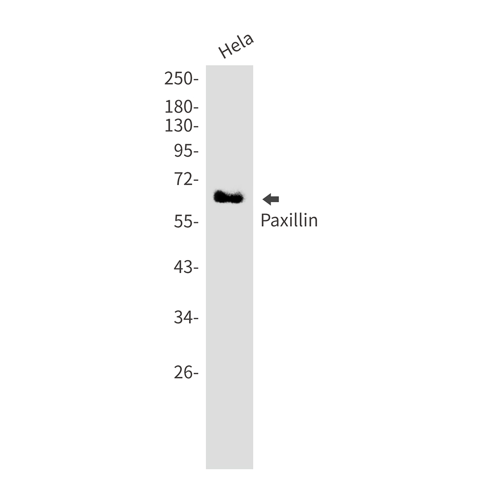 Paxillin Rabbit mAb ABZ2449