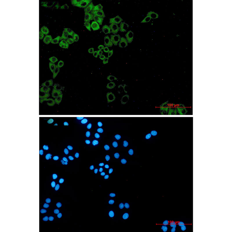 Paxillin Rabbit mAb ABZ2450