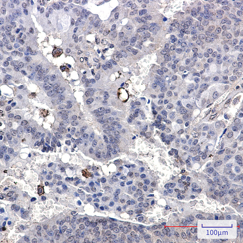 Paxillin Rabbit mAb ABZ2450