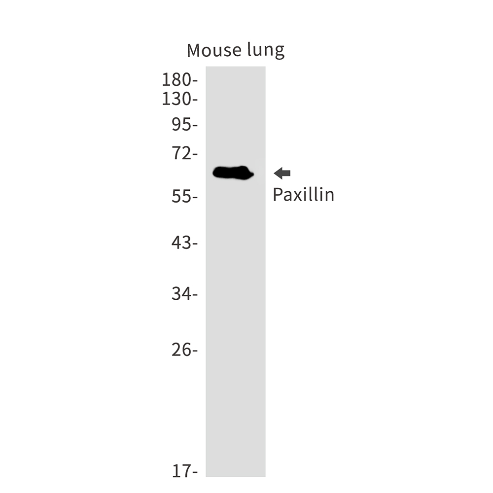Paxillin Rabbit mAb ABZ2450