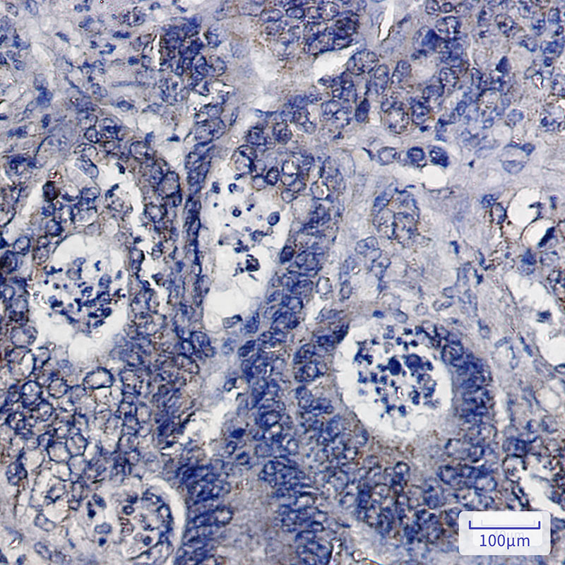 IDH2 Rabbit mAb ABZ2452