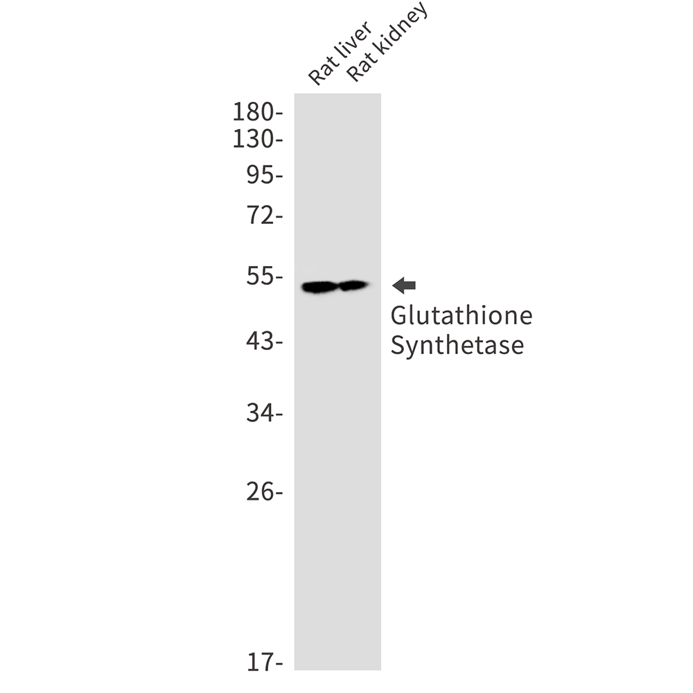 Glutathione Synthetase Rabbit mAb ABZ2453