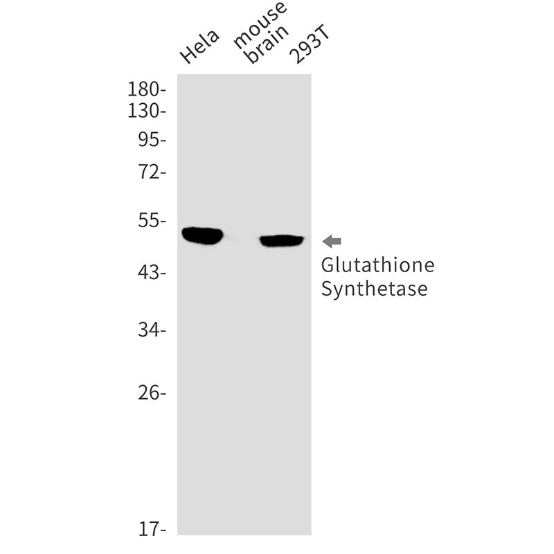 Glutathione Synthetase Rabbit mAb ABZ2453