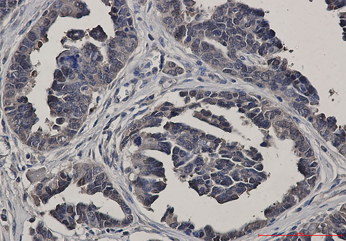 Glutathione Synthetase Rabbit mAb ABZ2454