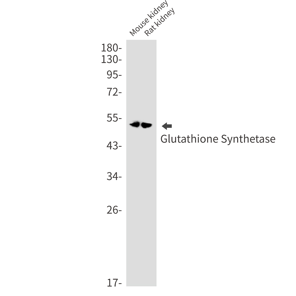 Glutathione Synthetase Rabbit mAb ABZ2454