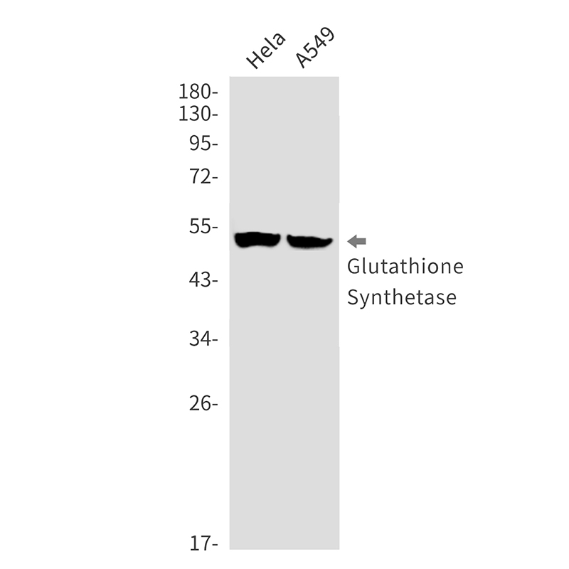 Glutathione Synthetase Rabbit mAb ABZ2454