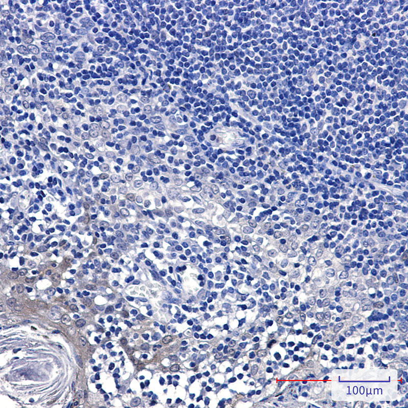 GCLM Rabbit mAb ABZ2455
