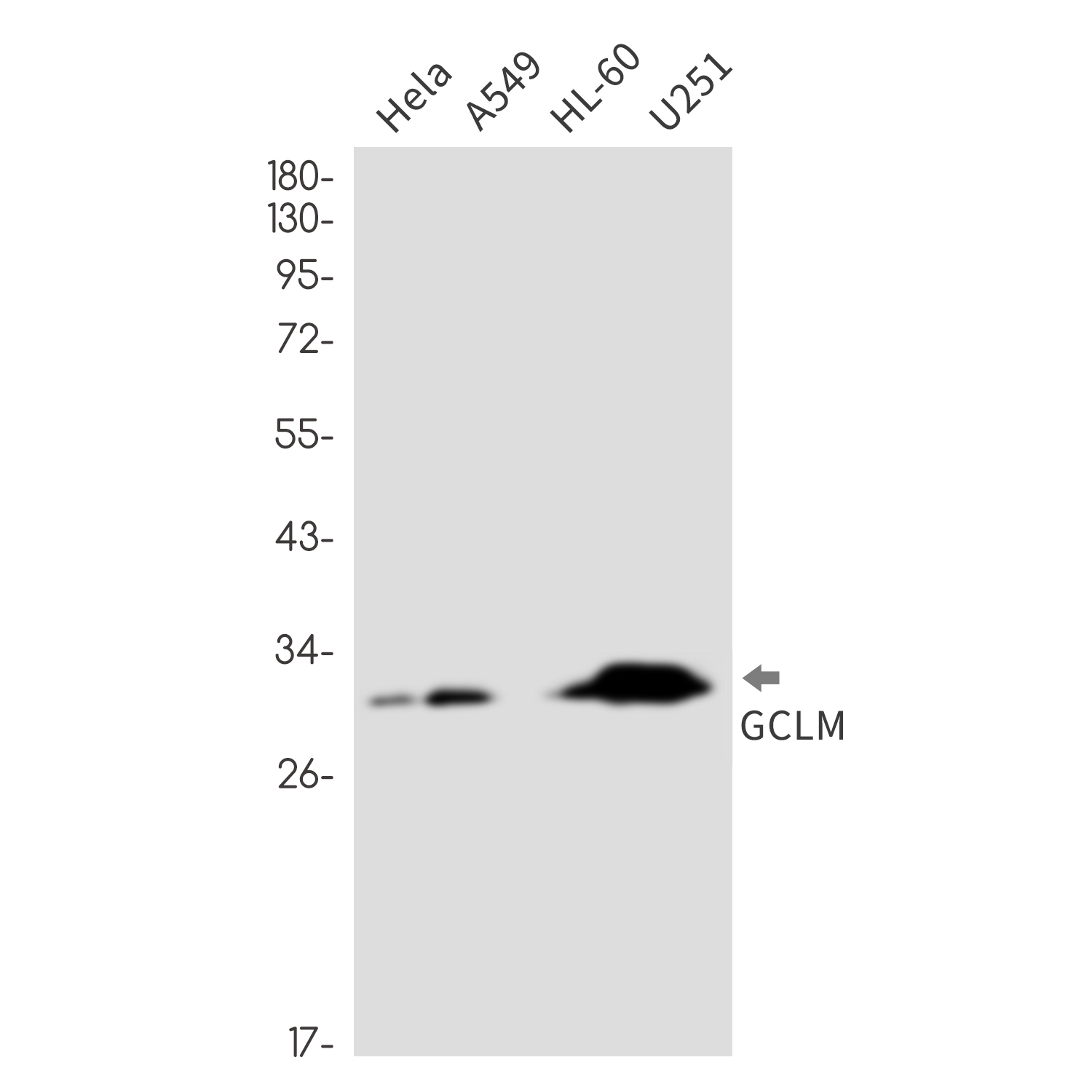 GCLM Rabbit mAb ABZ2455