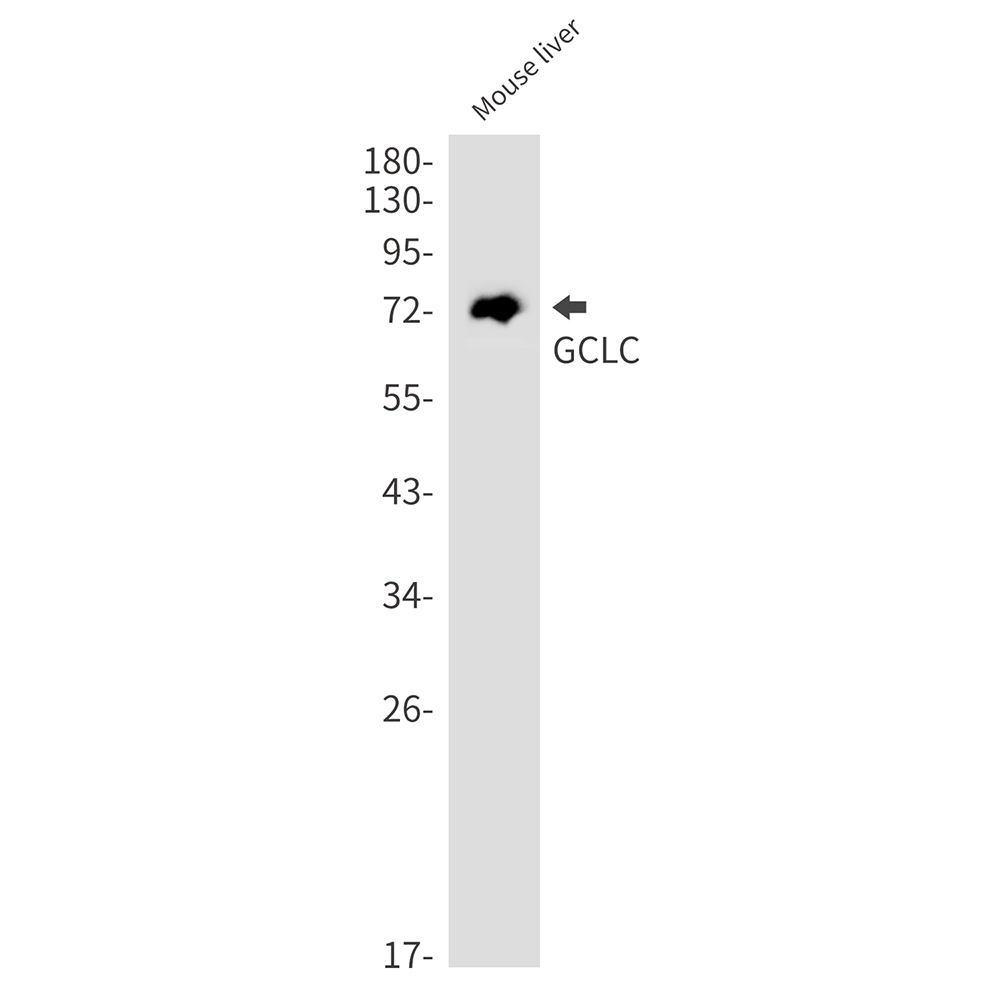 GCLC Rabbit mAb ABZ2456