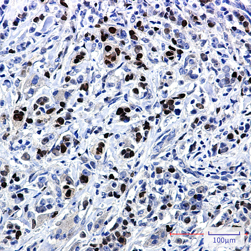 SOX9 Rabbit mAb ABZ2458
