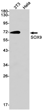 SOX9 Rabbit mAb ABZ2458