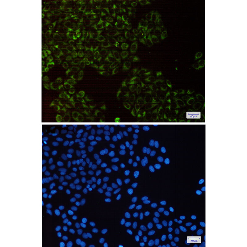UQCRFS1 Rabbit mAb ABZ2460