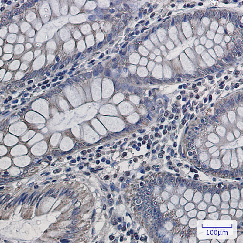 UQCRFS1 Rabbit mAb ABZ2460
