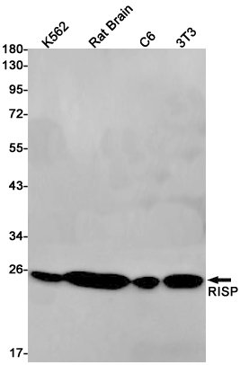 UQCRFS1 Rabbit mAb ABZ2460