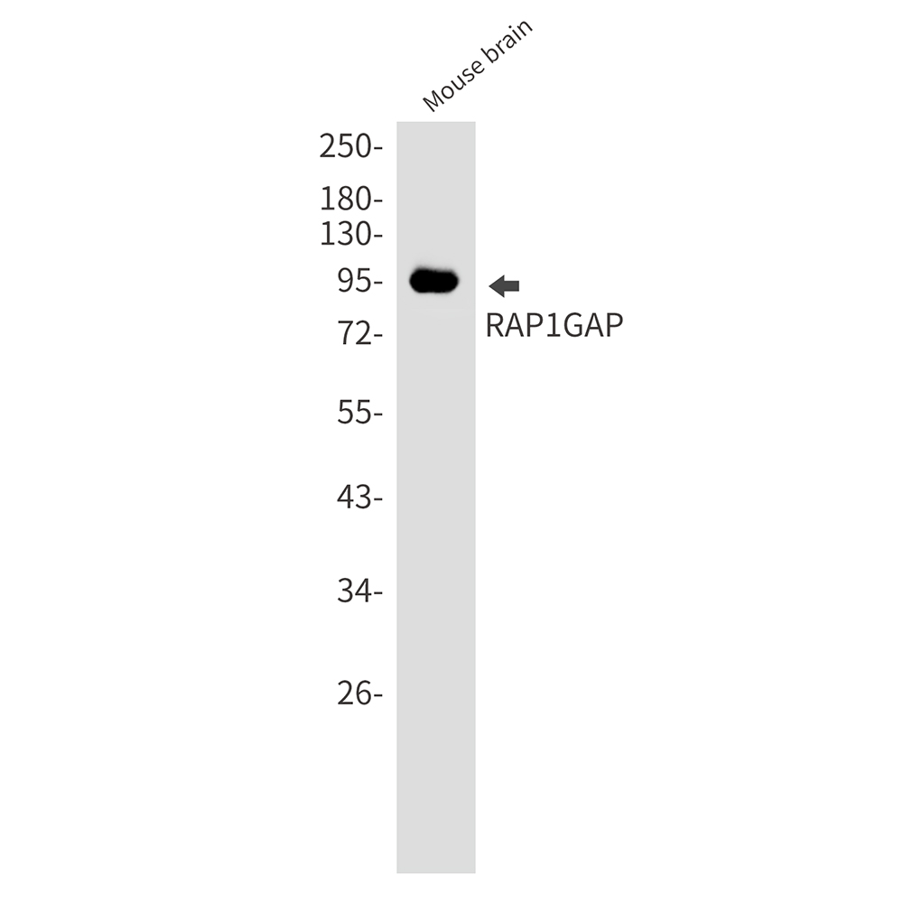RAP1GAP Rabbit mAb ABZ2463