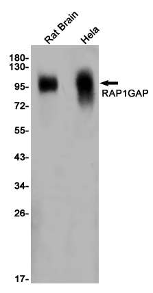 RAP1GAP Rabbit mAb ABZ2463