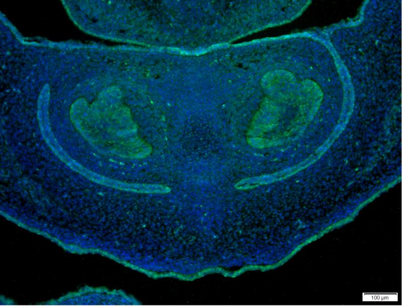YAP1 Rabbit mAb ABZ2465