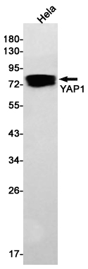 YAP1 Rabbit mAb ABZ2465