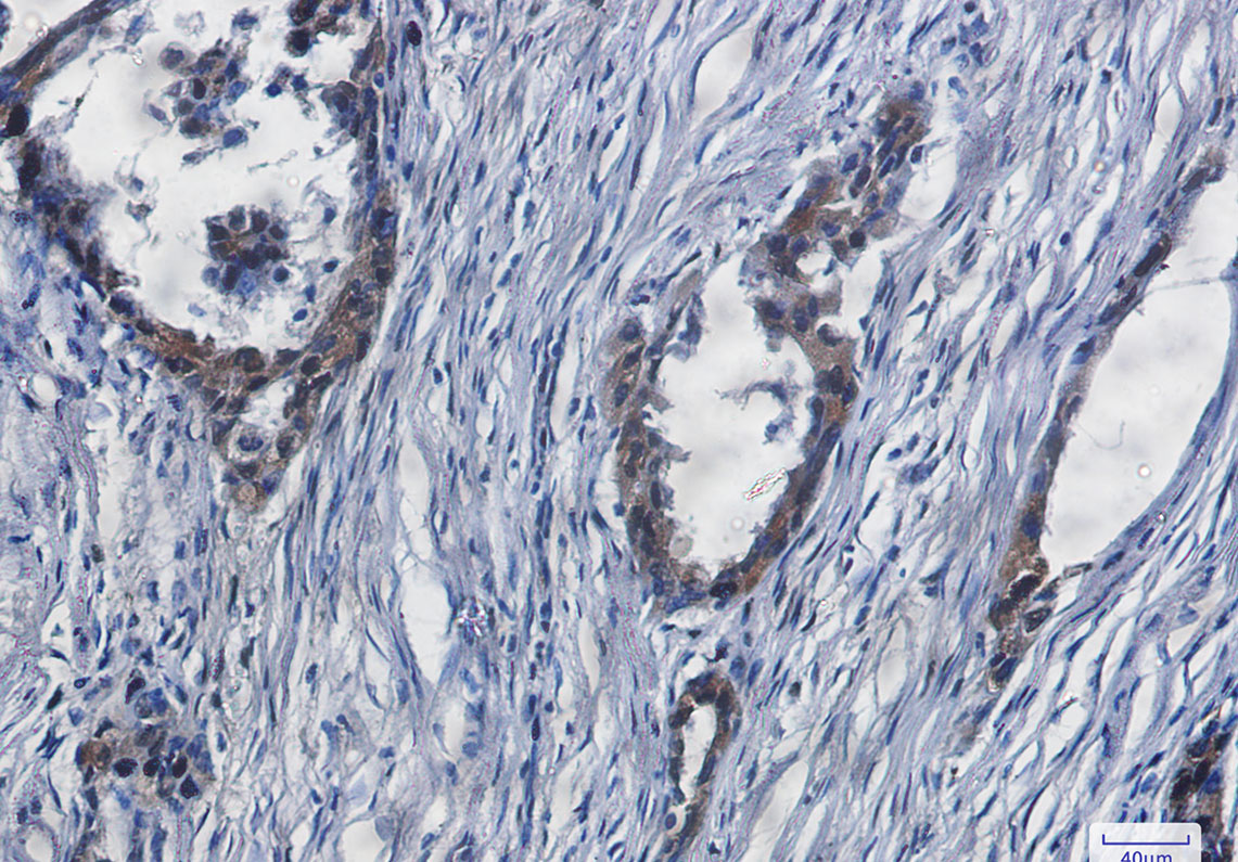 YAP1 Rabbit mAb ABZ2466