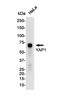YAP1 Rabbit mAb ABZ2466