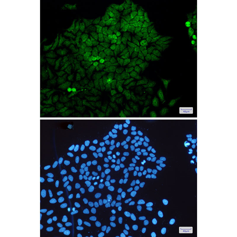 MEK3 Rabbit mAb ABZ2469