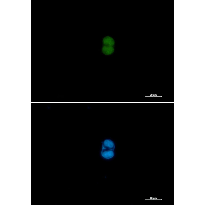 MEK3/MEK6 Rabbit mAb ABZ2470