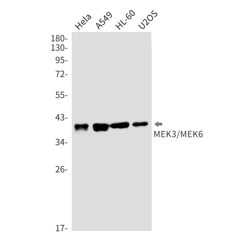 MEK3/MEK6 Rabbit mAb ABZ2470