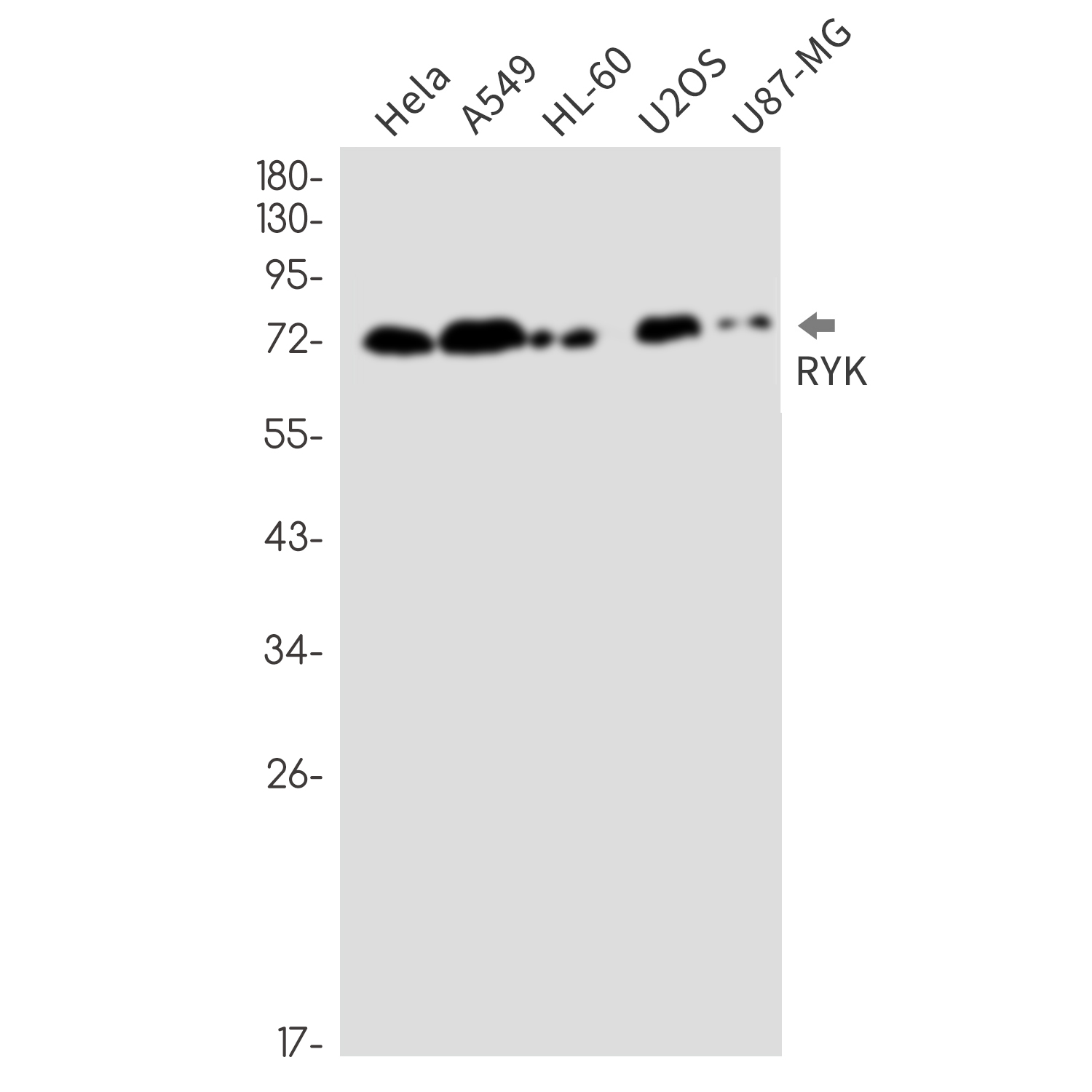 RYK Rabbit mAb ABZ2471