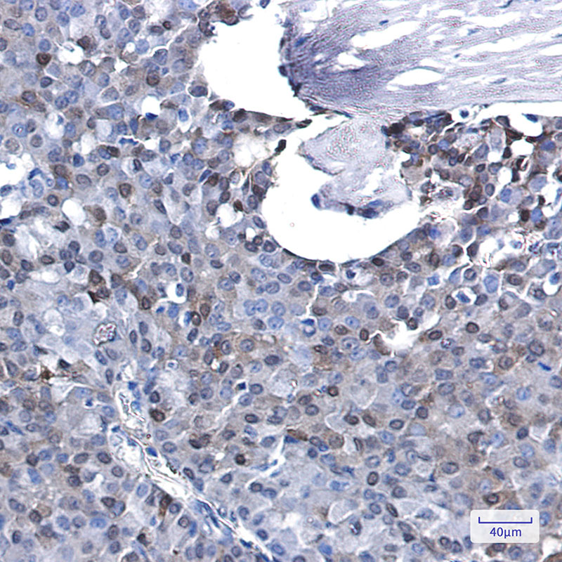 p27 KIP 1 Rabbit mAb ABZ2472
