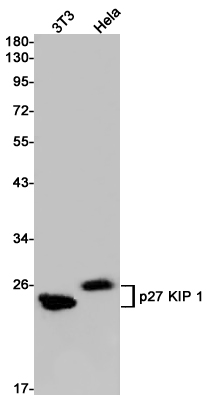 p27 KIP 1 Rabbit mAb ABZ2472