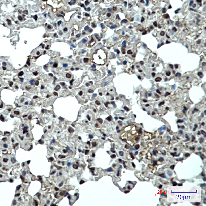 p27 Kip 1 Rabbit mAb ABZ2473