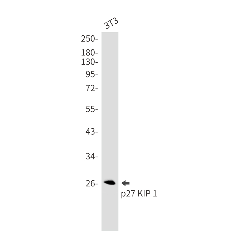 p27 Kip 1 Rabbit mAb ABZ2473