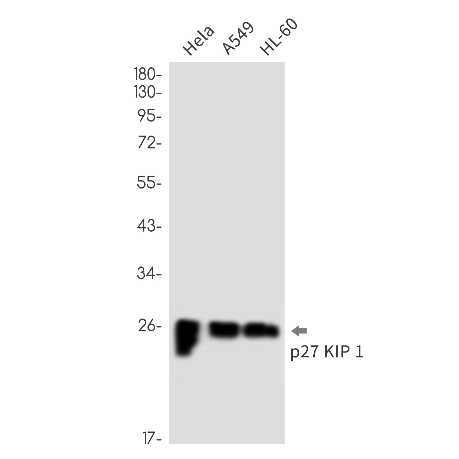 p27 Kip 1 Rabbit mAb ABZ2473